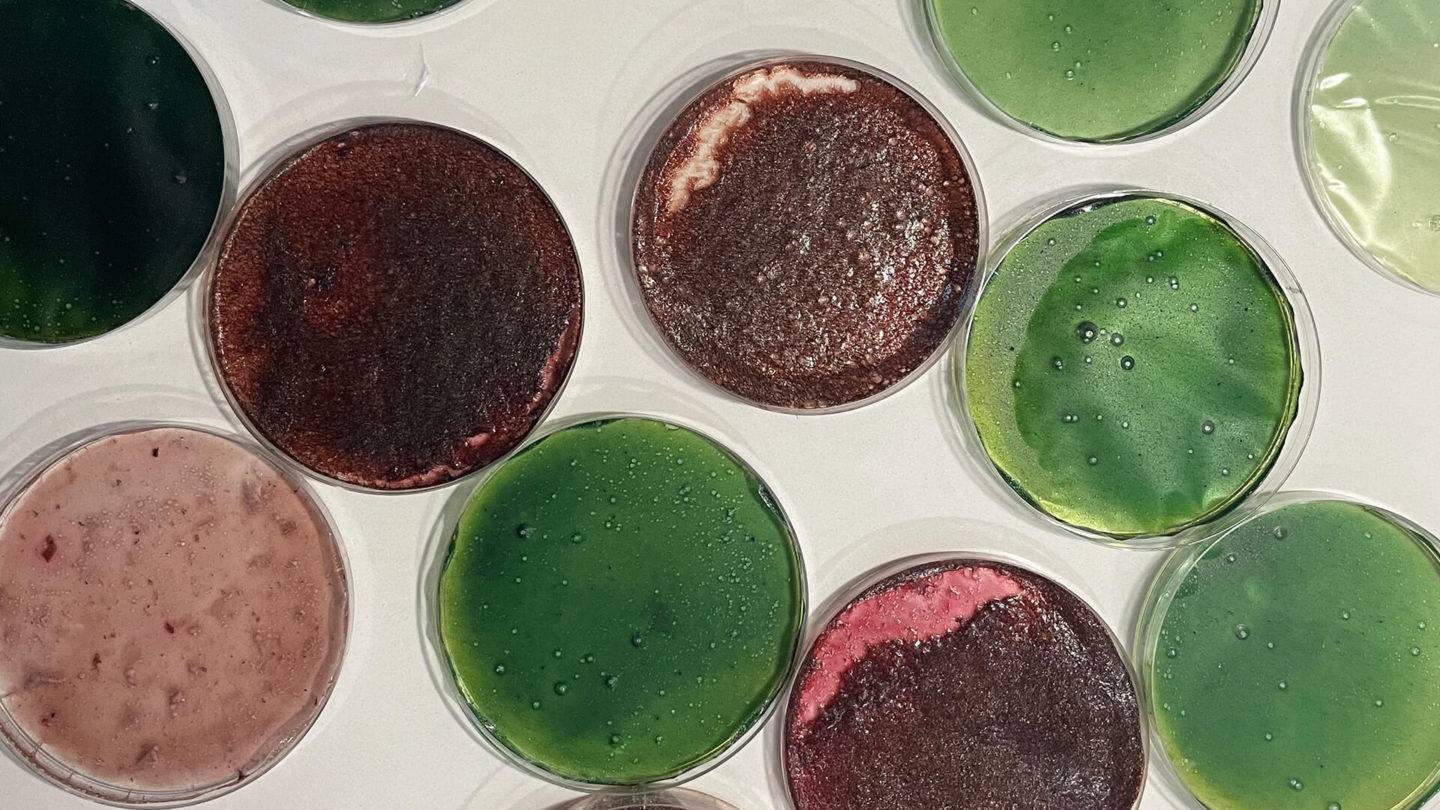 Biodegradable ECG samples